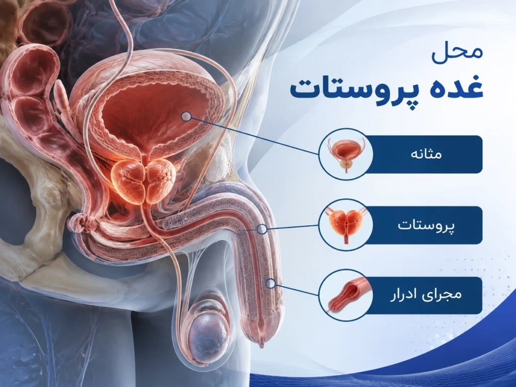 محل غده پروستات