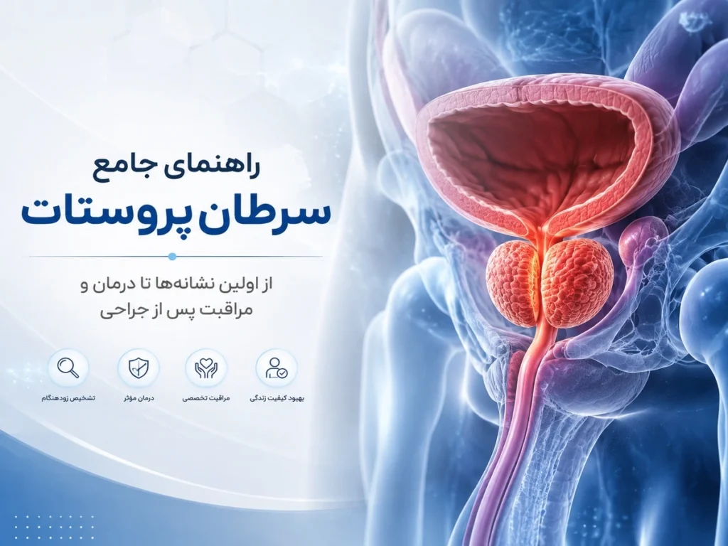 راهنمای جامع سرطان پروستات
