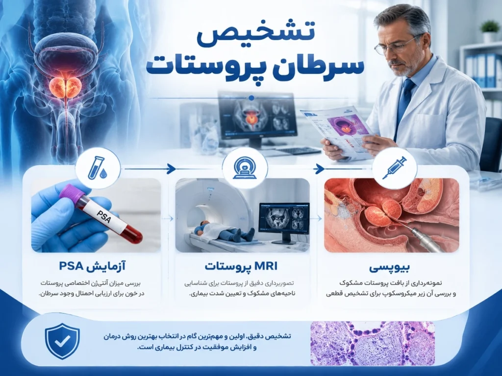 تشخیص سرطان پروستات