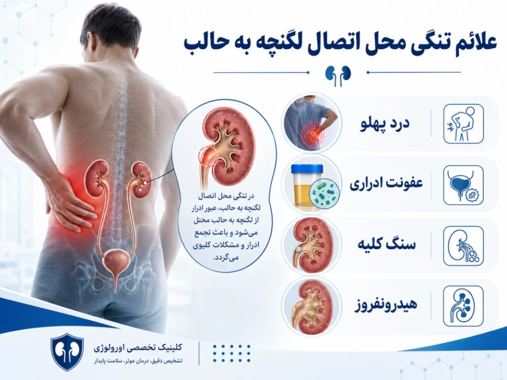 علائم تنگی محل اتصال لگنچه به حالب