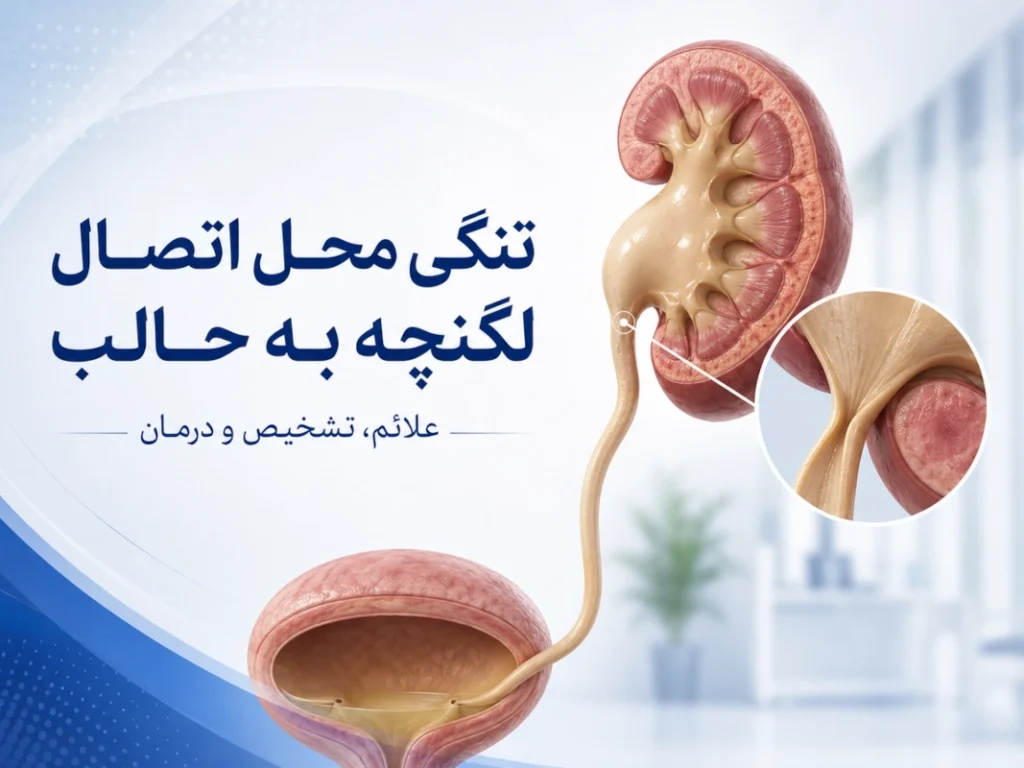 بررسی جامع تنگی محل اتصال لگنچه به حالب